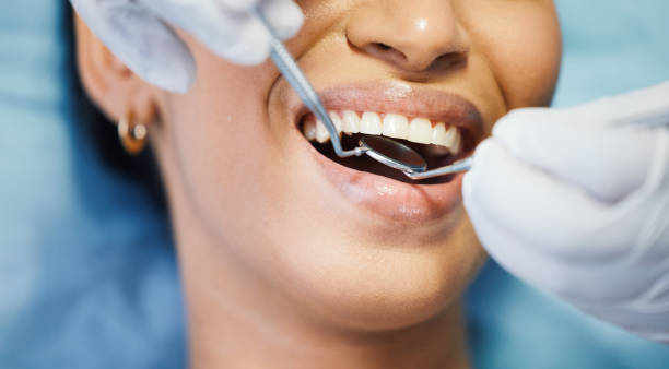 Best Pediatric Emergency Dentist in Little Canada, MN