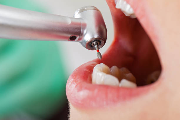 Best Pediatric Emergency Dentist in Little Canada, MN